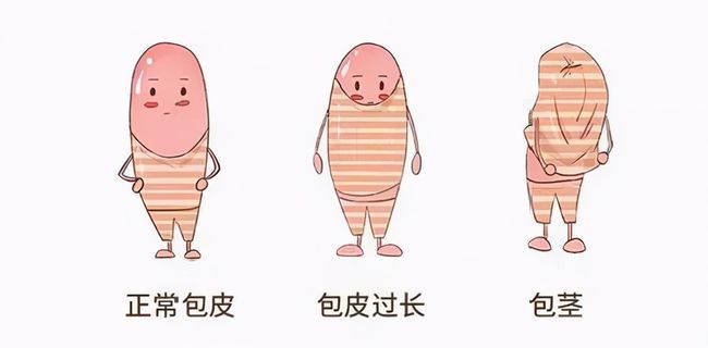 儿童包皮一定要切吗,齐齐哈尔附大男科PT官方网站-PT(中国)一站式服务官方网站
